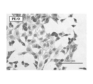 Obrázek 11: Příklad růstu buněk na polymerních substrátech upravených iontovou implantacíiontů O +,N + senergií150kev(fotografiezoptickéhomikroskopu) teriálech leptáním elektronovým svazkem nebo