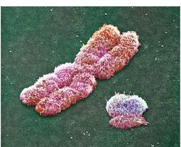 Nepárové pohlavní chromosomy Chromosom Y dědičnost po