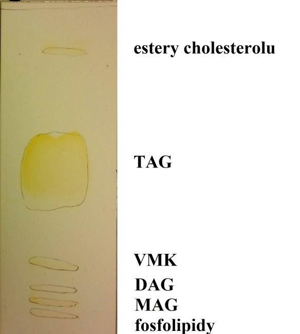 Obr. 4 Eluční schéma lipidických frakcí na TLC; schematicky (vlevo) [33,35], skutečné (vpravo) 4.