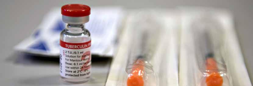 Nádobka s tuberkulínem. Dávka obsahující dvě jednotky tuberkulínu v roztoku 0,1 ml se injekčně podává pod horní vrstvu kůže a za 48 až 72 hodin se vyhodnotí výsledky.