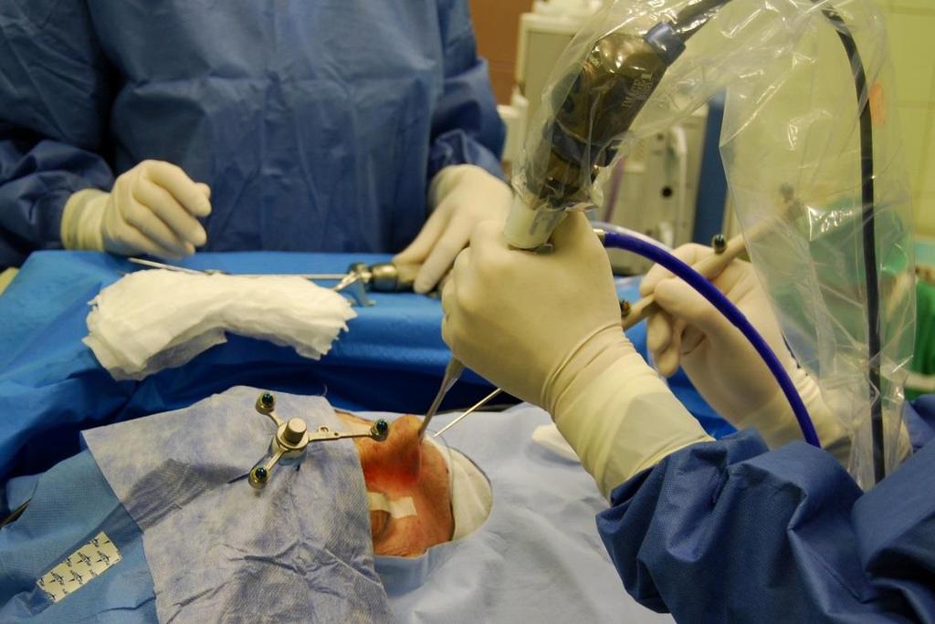Lékaři ORL kliniky Pardubické nemocnice poprvé operovali pacienta pomocí počítačem navigované chirurgie, jehož nákup byl financován z Integrovaného