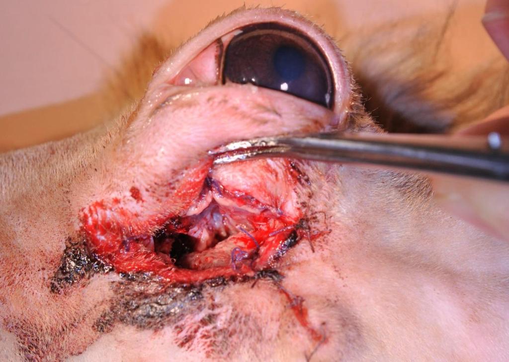 Odstranění faciálního abscesu