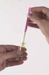 ACTIM PANCREATITIS DIPSTICK IMUNOCHROMATOGRAFICKÝ Ý RAPID TEST PRO DETEKCI TRYPSINOGENU 2 V MOČI MONOKLONÁLNÍ PROTILÁTKOU DOBA VYŠETŘENÍ - 5 MINUT CITLIVOST TESTU - 50 µg/l VÝROBCE - Medix Biochemica
