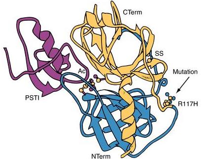 KOMPLEX TRYPSINOGEN - PSTI TRYPSIN JE INHIBOVÁN PANCREATIC SECRETORY TRYPSIN INHIBITOREM SCHOPNÝ INAKTIVOVAT AŽ 20% TRYPSINU C-TERM SS AC MUTACE