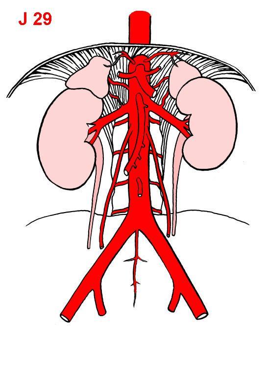 AORTA ABDOMINALIS 1 4 Větve parietální a. phrenica inf. aa. lumbales (4x) Větve viscerální nepárové 1 - truncus coeliacus 2 - a.