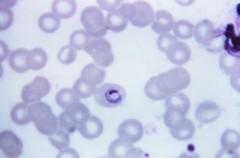 Plasmodium ovale P. ovale (třídenní malárie, terciána), podobný vývojový cyklus jako P.