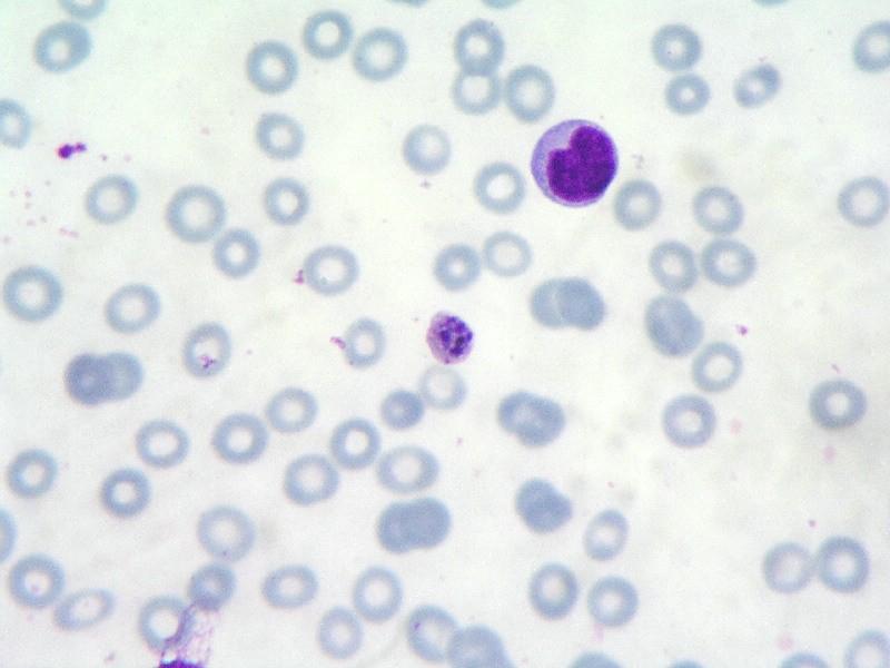 Plasmodium malariae původce čtyřdenní malárie (kvartány) nejmladší prstýnky se podobají prstýnkům P.