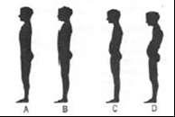 DRŽANIE TELA Držaním tela označujeme vzájomnú polohu jednotlivých častí tela hlavy, trupu, končatín v stoji, alebo pri každej pohybovej činnosti.