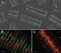 Figure 1: Microscopic images of a colonial diatom Fragilaria crotonensis.