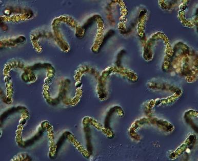 Filamentous cyanobacterium Dolichospermum crassum. / Vláknitá sinice Dolichospermum crassu.m. Foto P. Znachor.