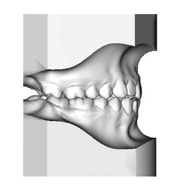 ORTODONCIE studie Initial