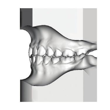 Upper (N-ANS/N-Gn) (%) 91.