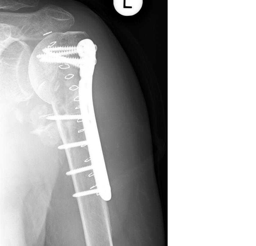 OA Dr.Binder Z.