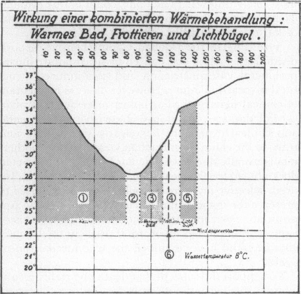 Hypotermie trocha historie Dachau, srpen 1942květen 1943 asi 360400 dobrovolníků z řad ruských válečných zajatců i civlních vězňů 280300 obětí!