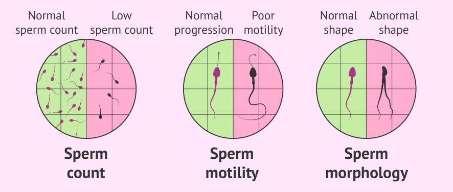 Věk a kvalita spermií - spermiogram Meta-analýza 90 klinických studií, 94 000 mužů S