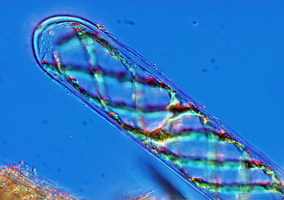 Spirogyra