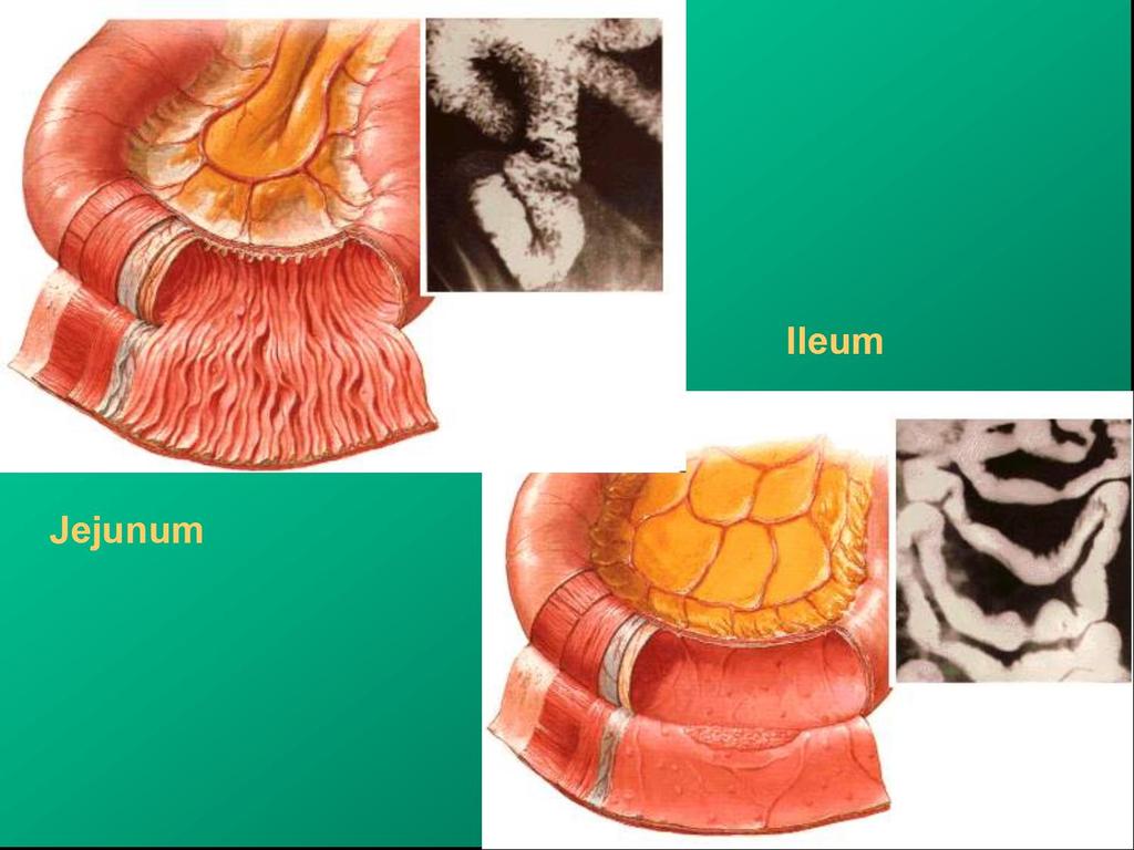 JEJUNUM et ILEUM Rozdíly: slizniční řasy, cévní