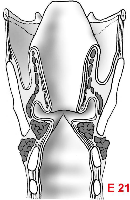 X. plicae vestibulares Frontální řez plicae