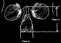 According to Broca: N.I. < 48 = leptorrhine N.