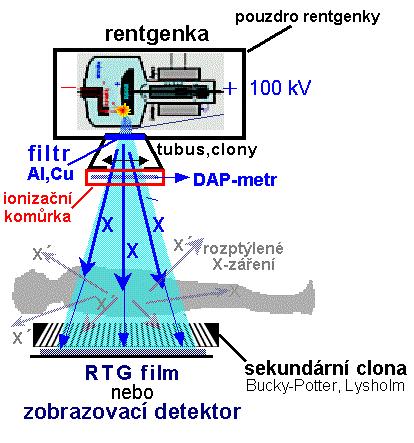 b) Lysholmova clona (paralelní) má 28 lamel/1 cm, které jsou jemnější a během skiagrafie se nemusí pohybovat. Často se používá u pojízdných přístrojů.