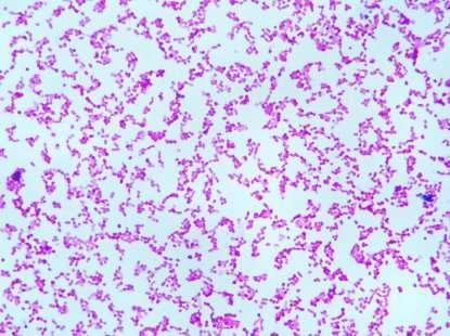 Prevalence karbapenem-rezistentních enterobakterií v gastrointestinálním traktu hemato-onkologických pacientů Autor: Martin Kubec, Michaela Ducháčová, Školitel: MUDr.
