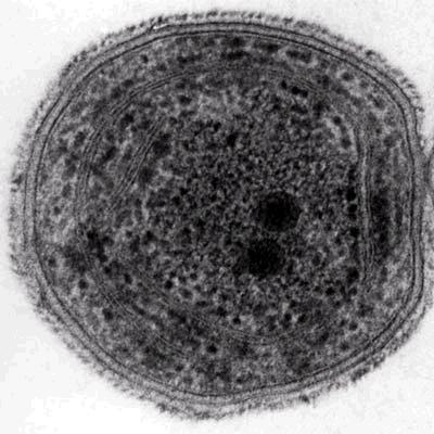 Prochlorococcus