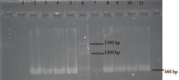 Obrázek 5. Agarozová gelová elektroforéza produktů PCR (466 bp) specifických pro doménu Bacteria Běh č.