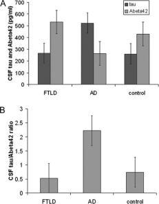 MM v dif. dg. FTLD x AD Parkinsonova choroba Bian 28 P-tau Sens. 84%, spec. 78% P-tau/Abeta42 Sens. 87%, spec.