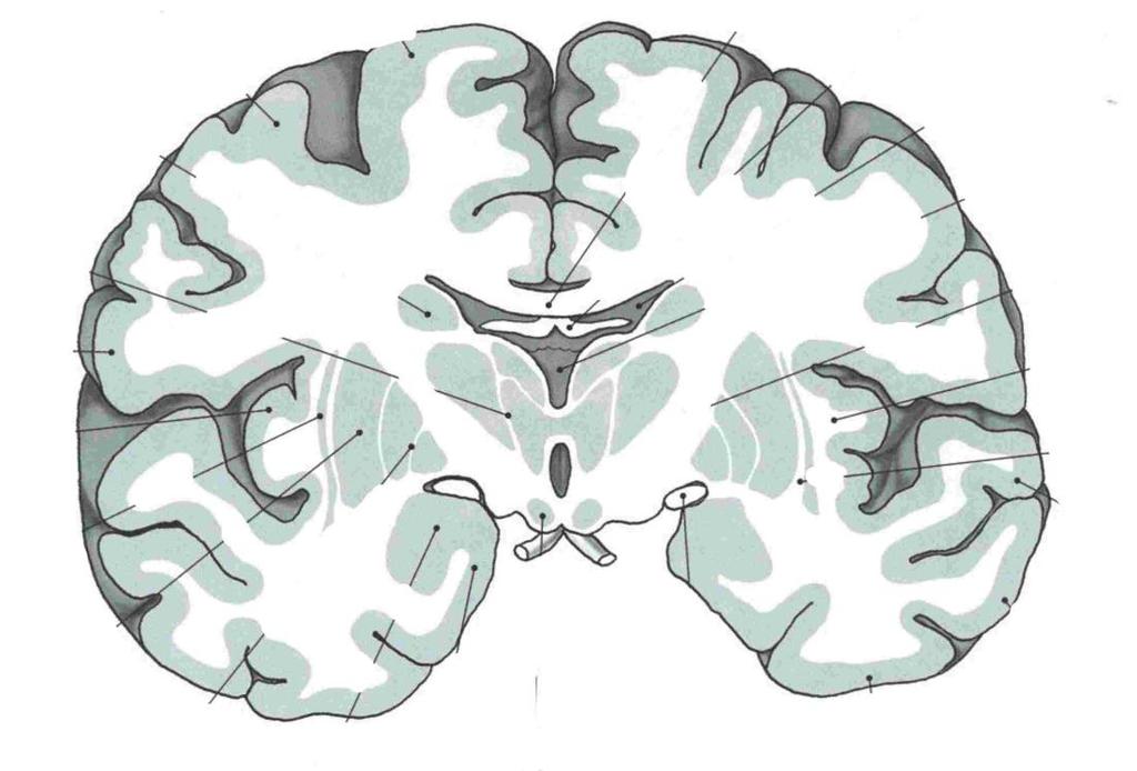 fontální řez mozkem horizontální řez mozkem bazální ganglia