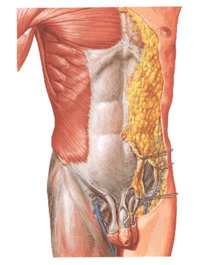 Svaly břicha boční skupina m. obliquus externus abd. lig.