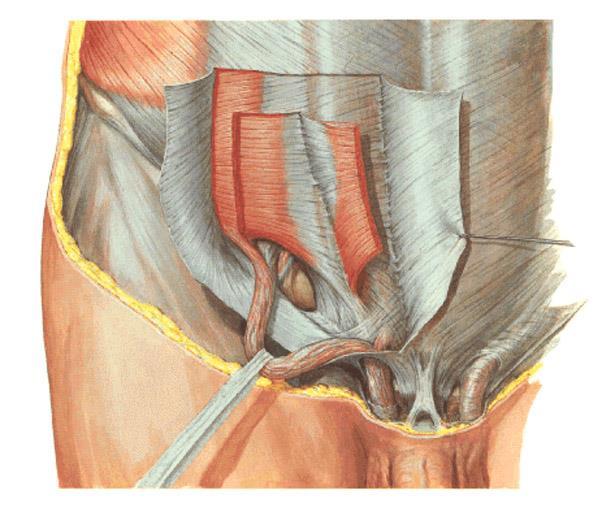 = zdvihač varlete M. cremaster derivát m. obliquus internus abd. (+ m. transversus abd.