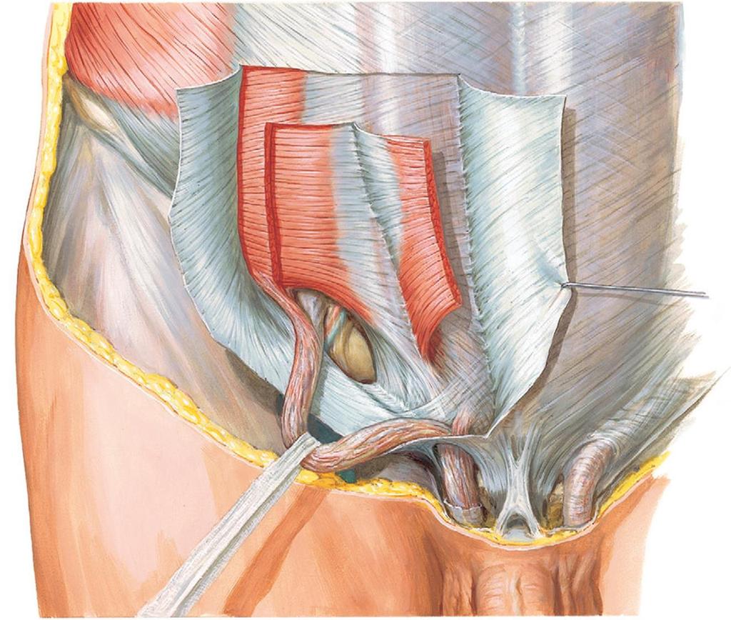 Ligamentum