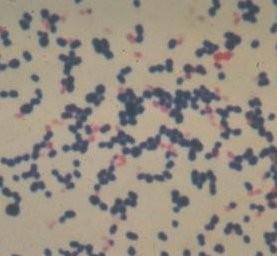 Multirezistentní Gram+ patogeny Staphylococcus aureus
