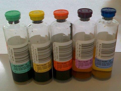 Najprv sa vykoná dezinfekcia odberového miesta a zátky odberovej súpravy dvoma dezinfekčnými prostriedkami: 70% alkoholom a 2% jódovou tinktúrou.