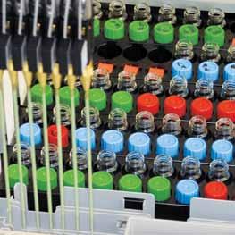 vyšetrenia hepatálnych testov: ALT, AST, GMT, ALP, celkový a konjugovaný bilirubín, posúdenie metabolizmu železa: železo, celková a voľná väzbová kapacita Fe, feritín, vyšetrenia pri poruchách