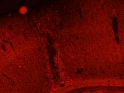 Našli jsme krevní globuliny (IgG) infiltrované do mozkové kůry (příp. hippocampu), zatímco pronikání klasických ukazatelů porušení BBB EB nepozorujeme ve stejně velké oblasti.