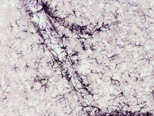 Obr. 11 Morfologie buněk makroglie Astrocyty v korové části mozku obarvené imunohistochemicky na GFAP.