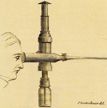 2 Základy panoramatické hysteroskopie 2 Základní data historie hysteroskopie 1 David Kužel V roce 1804 představil P. Bozzini svůj Lichtleiter [1, 2] a v roce 1853 A. J.