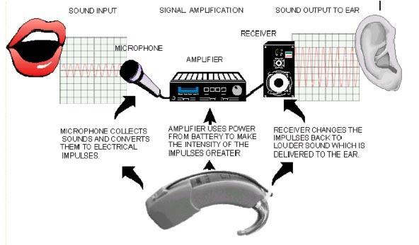 Korekce poruch slyšení Sluchadla: mikrofon, zesilovač, zdroj energie a vhodný reprodukční systém. Ten mívá tvar sluchátka s nástavcem, který se zasouvá do zevního zvukovodu.