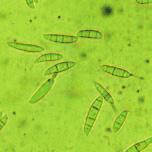 Říše Třída Přežívá Onemocnění Fungi Anamorphic Fungi osivo, pozemek