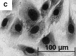 Obr. 2 Morfologická charakterizace MSC izolovaných z kostní dřeně. MSC mají vřetenovitý tvar podobný fibroblastům s nápadným jadérkem nepravidelného tvaru. Obarvené Giemsa-Romanowski.