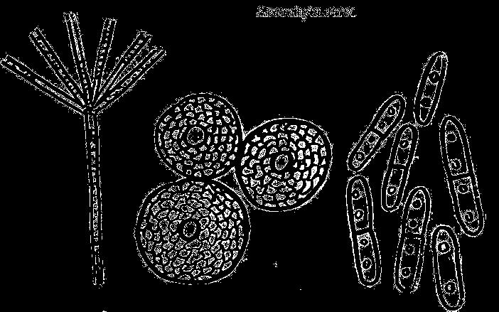 Askochytová listová skvrnitost a hnědnutí okolíků kmínu (Ascochyta carvi) Symptomy: Květenství: hnědnutí okolíků s tvorbou četných plodniček (pyknid)