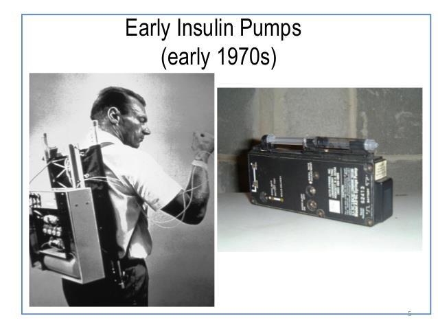 CSII: Continuous Subcutaneous Insulin Infusion Inzulínová pumpa Bazální dávkování Spojité