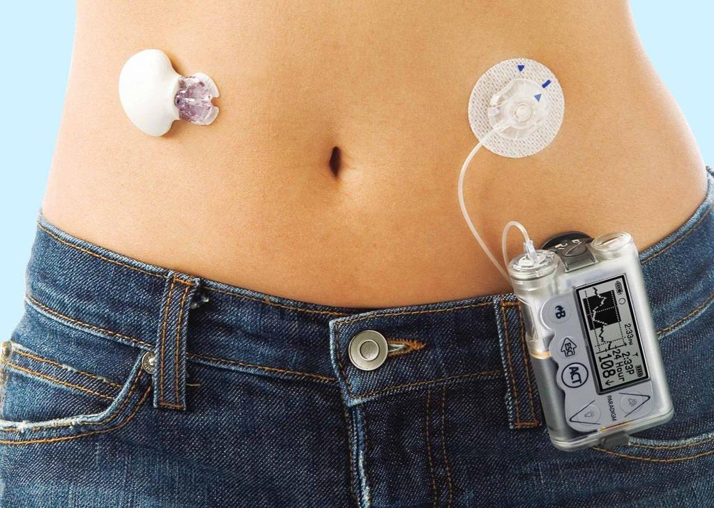 Continuous Glucose Monitoring (CGM) Měření