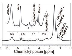 Objem VOI = 5 ml; B H MR spektrum z VOI o objemu 5 ml při 3 T, sekvence PRESS s TE/TR = 35/~ 5000 ms bez potlačení signálu vody se čtyřmi akvizicemi při zadržení dechu.