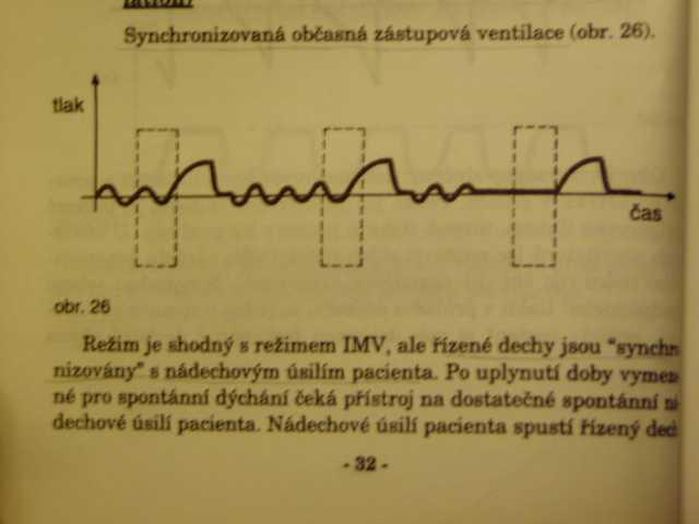 SIMV synchronized intermittent mandatory ventilation synchronizovaná zástupná ventilace; (dnes v praxi SIMV+ PS) odpojování Pokud v časovém