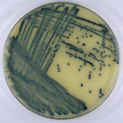 5.3 Výsledky studie An imported case of bloody diarrhea in the Czech Republic caused by a hybrid enteroaggregative hemorrhagic Escherichia coli (EAHEC) O104:H4 strain associated with the large