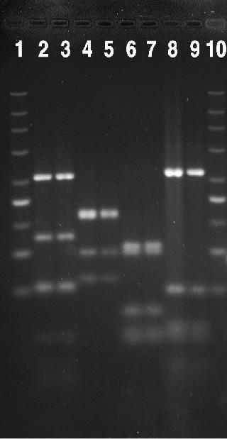 Příloha 10.2 Geny kódující faktory virulence EHEC Čtyřicet devět EHEC izolátů patřilo celkem k 7 stx genotypům.