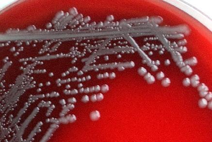 Příloha 10.2 A Obr. 3. Cytotoxický účinek Stx na buňky linie Vero A. Kultura Vero buněk po 3 dnech inkubace se supernatantem kmene EHEC (> 90 % cytotoxicita). B.