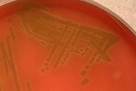 EHEC-Hly fenotyp kmene EHEC na EHLY agaru (A) ve srovnání s absencí hemolýzy u stejného kmene na běžném krevním agaru (B) Diagnosticky důležité fenotypy EHEC Čtyřicet osm ze 49 EHEC izolátů